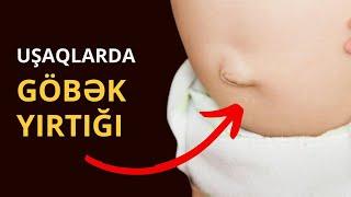 GÖBƏK YIRTIĞI: Özü sağalır? / Toğrul Ömərov