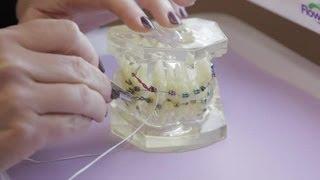 How to Remove  Floss Trapped Between Teeth : Caring for Your Teeth