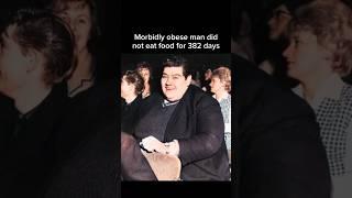 Angus Barbieri, a morbidly obese man, has not eaten food for more than a year.