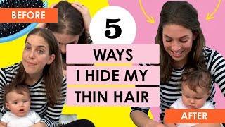 5 Ways I Hide My Thin Hair (Postpartum Hair Loss)