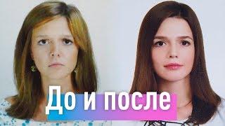 Как психотерапия изменила моё лицо