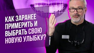 Цифровой дизайн улыбки что это?