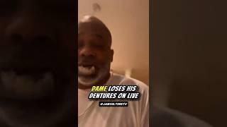 Yikes! Dame Dash Teeth Falling Out On Live #rap #celebrity