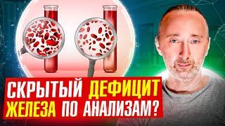 Дефицит ЖЕЛЕЗА проявляется в этих 10 анализах: вот их нормы! Знать их жизненно важно!