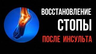 Как я восстанавливал стопу ноги после инсульта.