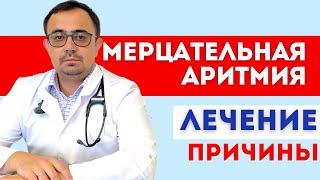 Мерцательная аритмия. Фибрилляция предсердий. Лечение.