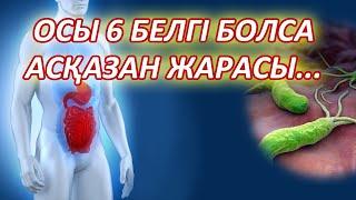 Мына 6 БЕЛГІ сізде болса АСҚАЗАН ЖАРАСЫ ауруынан, ГАСТРИТ ауруының 6 белгісі, Керек арнасы