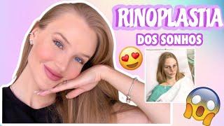 MINHA RINOPLASTIA: QUANTO CUSTOU/ ANTES X DEPOIS/ TUDO QUE VOCÊ PRECISA SABER POR - KELIN UESS