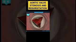 Aortic value stenosis and regurgitation. #studyanimated #biology #animation #science