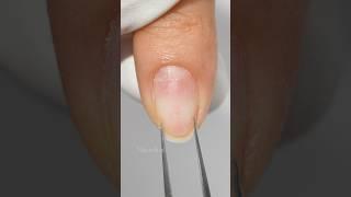  Must-See Tutorial for Thin & Soft Nails