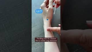 Needling LU 7 Acupuncture Point #acupuncturepoints