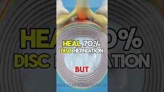 Sciatica & Disc Herniation Can Heal?