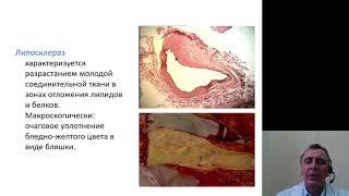 Патанатомия 8.Болезни сердечно сосудистой системы