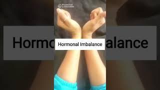 Maintaining hormonal imbalance #exercise #yoga short