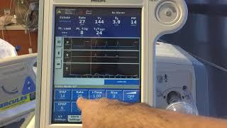 Non-Invasive Ventilation [NIV] - Basics