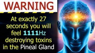 FULL PINEAL GLAND DETOXIFICATION (You'll Feel Better in 1 Listen)