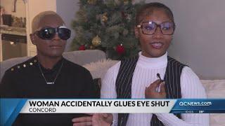 Concord woman warning others after accidentally gluing eye shut with nail glue