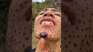 How crued a bug bite yngart in the wild survival skills #rustmonster #scavenger 