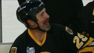 Miller loses a tooth during Alumni game