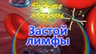 Застой лимфы. Почему появляются отеки под глазами, на руках и ногах и как от них избавиться