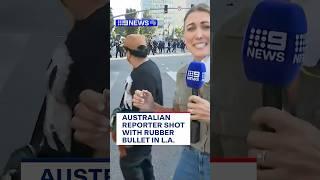 Australian reporter shot with rubber bullet in LA | 9 News Australia