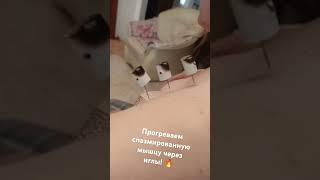 Прогреваем спазмированную мышцу через иглы! Ваш мануальный терапевт Олег Гудвин. ‍️ #массаж