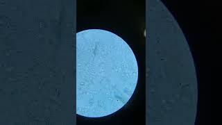 urine sample under microscope.