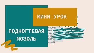 Как легко убрать подногтевую мозоль.