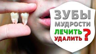 Зуб мудрости - вся правда! Зачем нам нужны зубы мудрости | Дентал ТВ