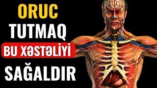 ORUC tutmaq bu Xəstəlikləri Sağaldır!