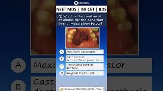 NEET MDS | INI-CET MDS | PSC | BDS - Most Important Questions  #neetmds2025 #mdsprep