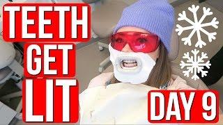 GETTING MY TEETH DONE! Vlogmas Day 9 | Meredith Foster