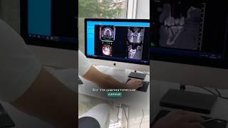 Консультация ортодонта #диагностика #кт #брекеты #ортодонт #dentist #элайнеры #стоматология #зубы