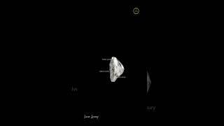 Fancy Lips Shape Lab Grown Diamond#ivevar#usa#labgrowndiamonds#fancy#trending#gift#jwellery#luxury