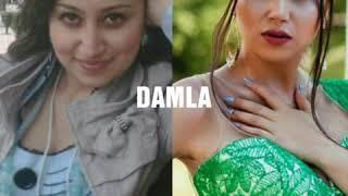 Plastik Emeliyyat Eden Meshurlarimiz Şok! Şok! Şok!