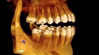 CBCT scans explained in 1:15