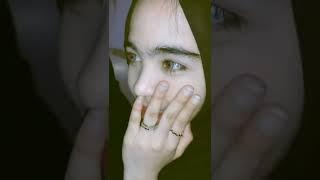 Cewek cantik berbulu berkumis tipis..#shorts #pemersatubangsa #tiktok