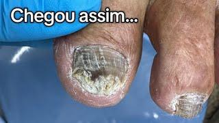 THE DOCTOR RECOMMENDED TAKE CARE OF YOUR NAILS/Podiatrist Renata Cavalcanti