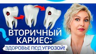 75% людей НЕ догадываются, что у них развивается вторичный кариес!