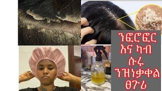 ሙሉእ ብሙሉእ ፈሮፎር ዘጥፍእ እና ካብ ስሩ ንዝመነቃቀል ፀጉሪ ብሉፅ መድሓኒት /home made anti dandruff oil / #tigray #ethiopia