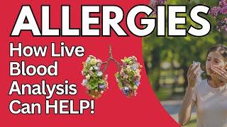 Allergies and Live Blood Cell