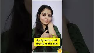 Max Care Virgin Coconut Oil for Dry and Frizzy Hair  No more Hairfall  #shorts #youtubeshorts