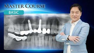 [Master Course - BASIC] What Is A Dental Implant