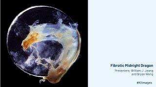 2024 Image Awards Lightning Talks - Fibrotic Midnight Dragon