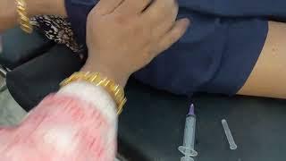 double side buttock injection video