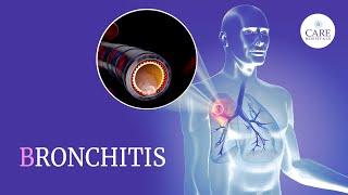 Know About Bronchitis: Types, Causes, Symptoms, Treatment And Prevention | CARE Hospitals