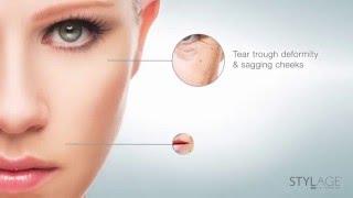 STYLAGE  DERMAL FILLERS BY VIVACY