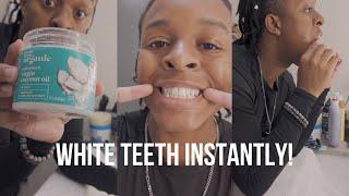 How To Get Your Teeth White | Dental Hygiene Routine