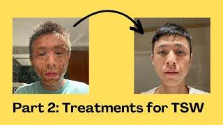 How should I treat Topical Steroid Withdrawal? (TSW Guide part 2) Good & Bad Treatments