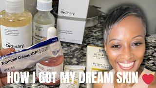 LIFE After 50  HOW I GOT MY DREAM SKIN | Tretinoin |ANTI - AGING Cream